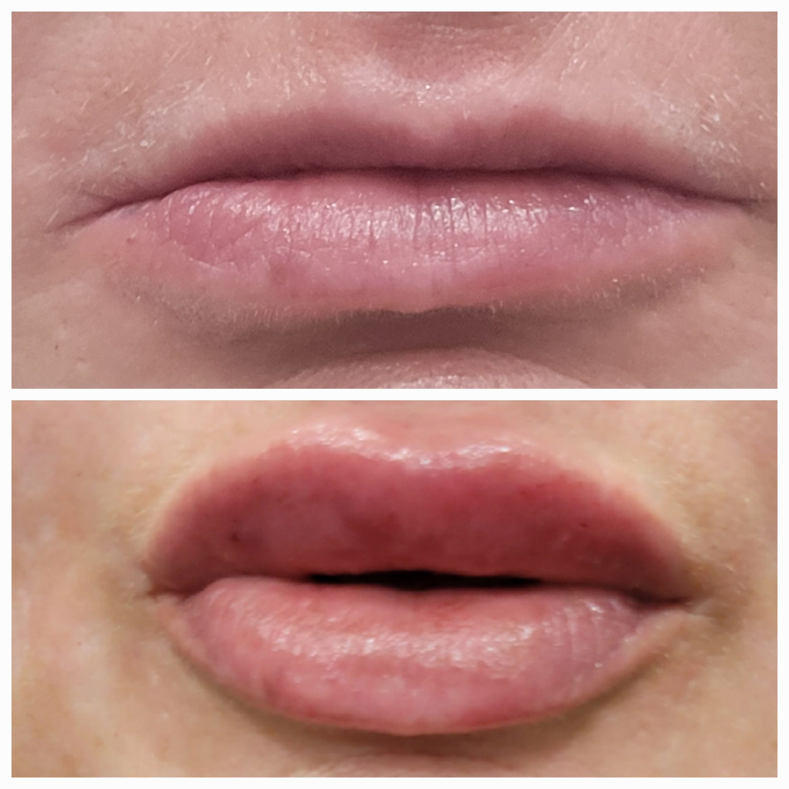 Lips 5